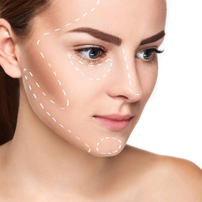 Derma filler Derma filler